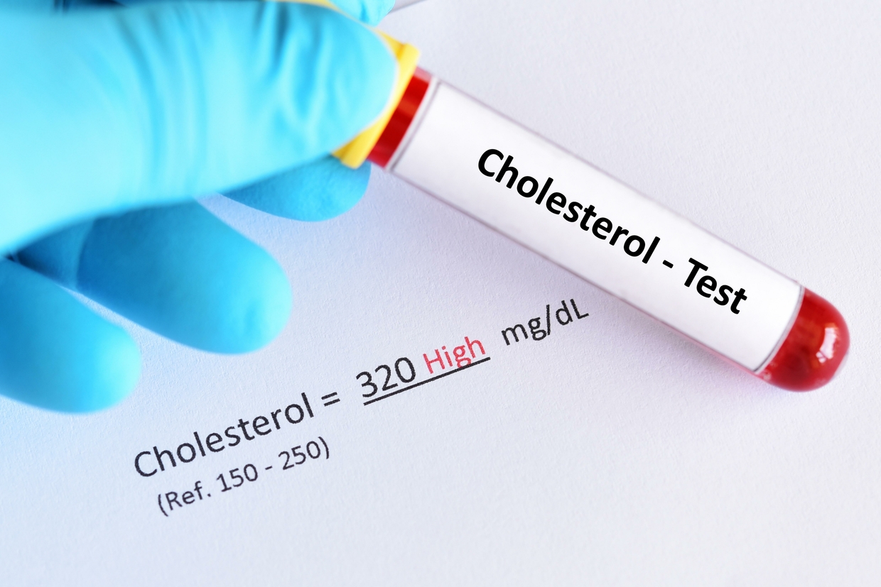 Beyond Cholesterol: What Really Shapes Heart Health?