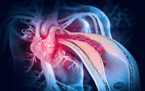 Why You Care About Triglycerides and Blood Glucose.