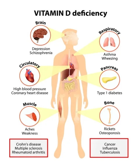 Why You Care About Vitamin D.