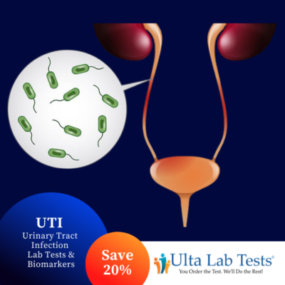 Ulta Lab Tests