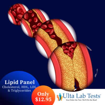 Ulta Lab Tests